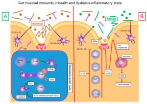 Picture of the gut mucosal immunity in health and dysbiosis